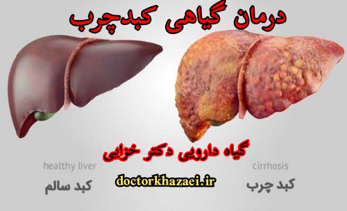 درمان گیاهی گرید های کبد چرب